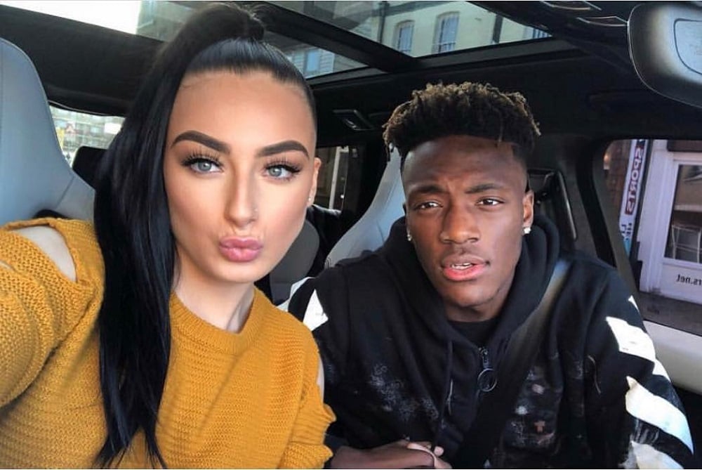 Tammy Abraham Eye