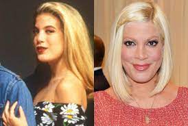 Tori Spelling Net Worth is a well-known American actress, author, and producer who gained popularity for her role as Donna Martin in the 1990s television